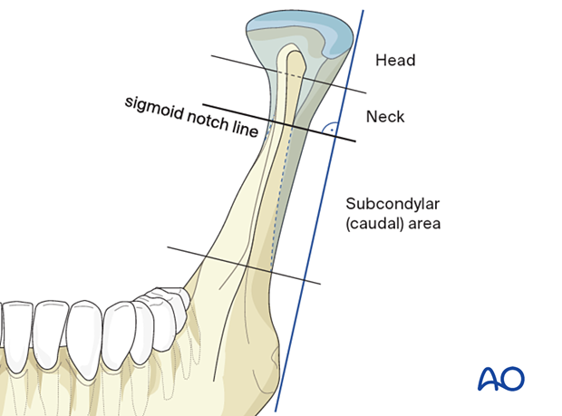 Mandible Sites