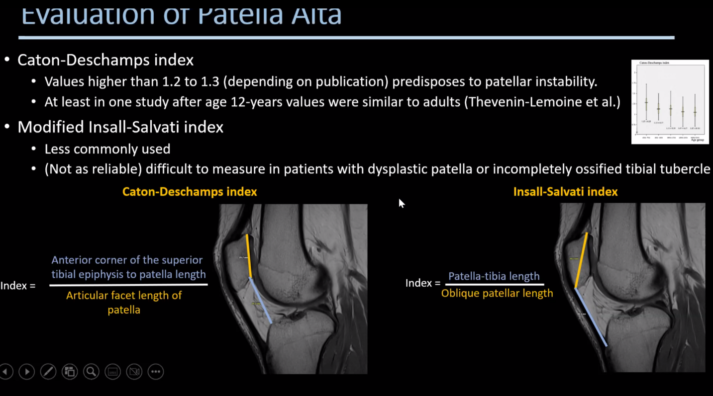 Patellar Maltracking