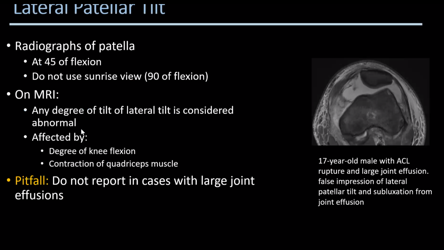 Patellar Maltracking