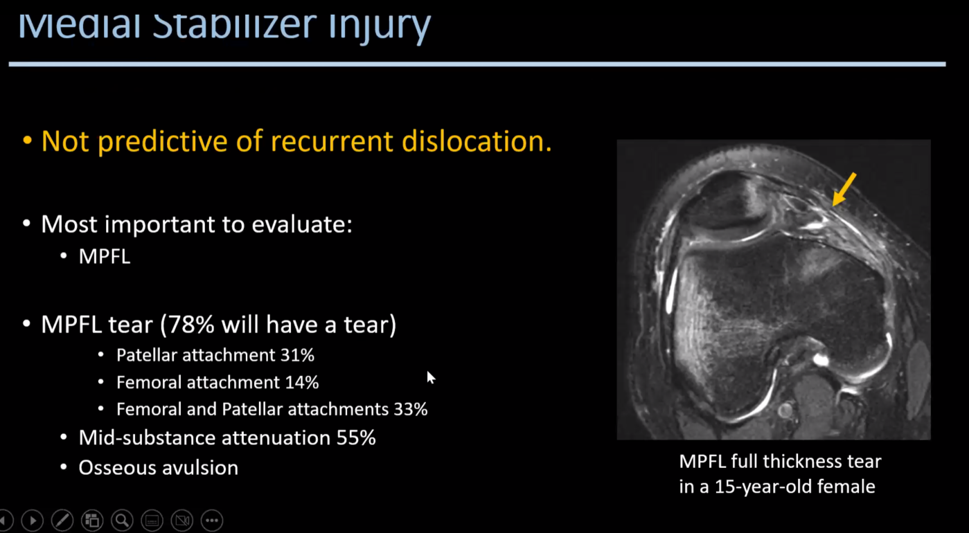 Patellar Maltracking