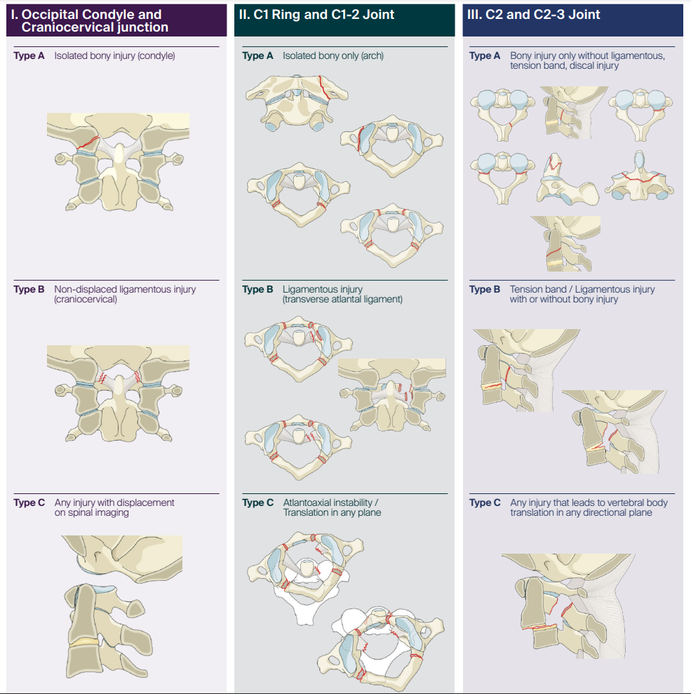 AO Upper Cervical Fracture