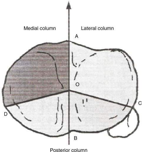 Tibial Plateau