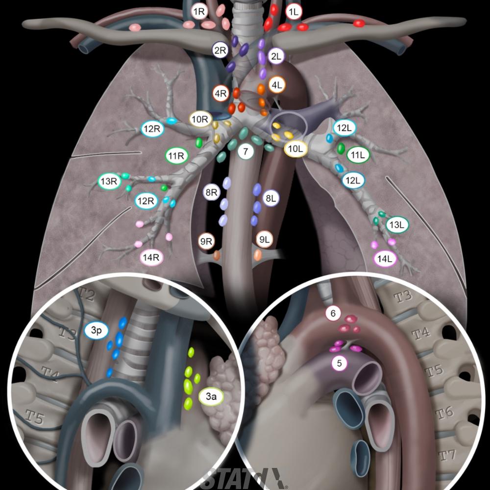 Chest Nodes