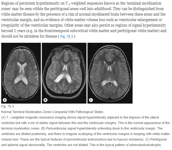 Normal Myelination