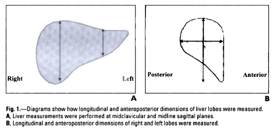 Liver Measurement